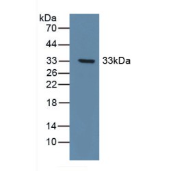 Discoidin Domain Receptor Family, Member 1 (DDR1) Antibody