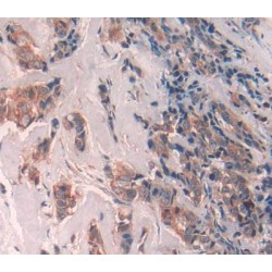 Hyaluronan Mediated Motility Receptor (HMMR) Antibody