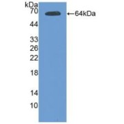 Western blot analysis of recombinant Mouse TEK.