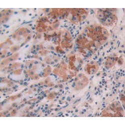 Lysosomal Associated Membrane Protein 3 (LAMP3) Antibody