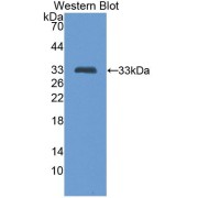 Western blot analysis of the recombinant protein.