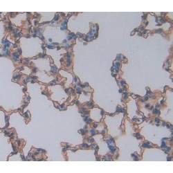 B- And T-Lymphocyte Attenuator (BTLA) Antibody