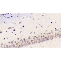 Toll Like Receptor 3 (TLR3) Antibody