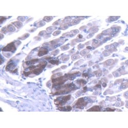 Toll Like Receptor 5 (TLR5) Antibody