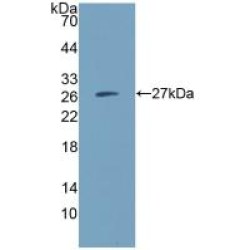 Immunoglobulin Superfamily, Member 16 (IGSF16) Antibody