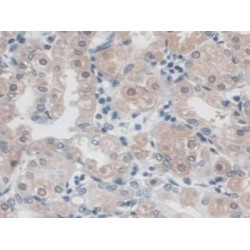 Immunoglobulin Superfamily, Member 16 (IGSF16) Antibody