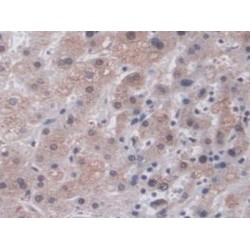 Immunoglobulin Superfamily, Member 16 (IGSF16) Antibody