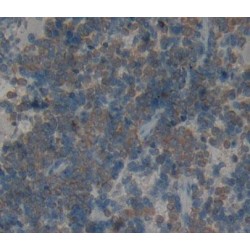 NKG2-D Type II Integral Membrane Protein (KLRK1) Antibody