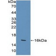 Western blot analysis of recombinant Human KLRK1.