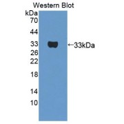 Western blot analysis of the recombinant protein.