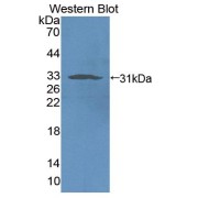 Western blot analysis of recombinant Rat NCR1.