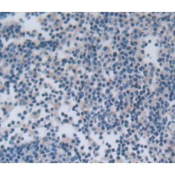 Natural Cytotoxicity Triggering Receptor 1 (NCR1) Antibody