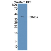 Western blot analysis of the recombinant protein.