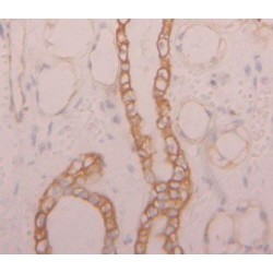 Natural Cytotoxicity Triggering Receptor 2 (NCR2) Antibody