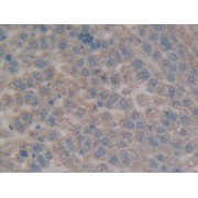 IHC-P analysis of Rat Liver Tissue, with DAB staining.