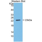 Western blot analysis of the recombinant protein.