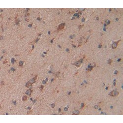 Choline Transporter Like Protein 1 (CTL1) Antibody