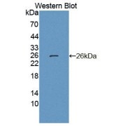 Western blot analysis of the recombinant protein.