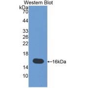 Western blot analysis of the recombinant protein.