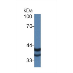 Pregnancy Specific Beta-1-Glycoprotein 2 (PSG2) Antibody