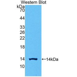 Chorionic Gonadotropin Beta Polypeptide 1 (CGb1) Antibody