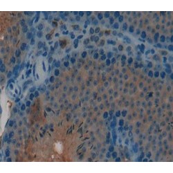 Chorionic Gonadotropin Beta Polypeptide 1 (CGb1) Antibody