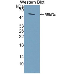 Coenzyme Q6 Homolog, Monooxygenase (COQ6) Antibody