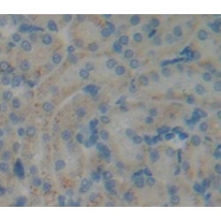 Coenzyme Q6 Homolog, Monooxygenase (COQ6) Antibody