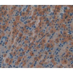 Megakaryocyte Associated Tyrosine Kinase (MATK) Antibody