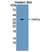 Western blot analysis of the recombinant Rat LPHN2 protein.