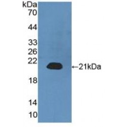 Calmodulin Like Protein 3 (CALML3) Antibody