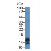 Western blot analysis of Human A431 cell lysate, using Human CALML5 Antibody (1 µg/ml) and HRP-conjugated Goat Anti-Rabbit antibody (<a href="https://www.abbexa.com/index.php?route=product/search&amp;search=abx400043" target="_blank">abx400043</a>, 0.2 µg/ml).