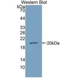 Calmodulin Like Protein 5 (CALML5) Antibody