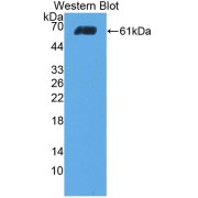 Western blot analysis of the recombinant protein.