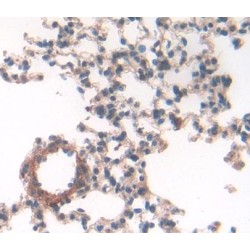 Colony Stimulating Factor 2, Granulocyte Macrophage (GMCSF) Antibody