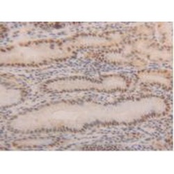 Proliferating Cell Nuclear Antigen (PCNA) Antibody