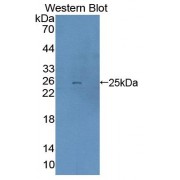 Western blot analysis of the recombinant protein.