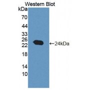 Western blot analysis of the recombinant protein.