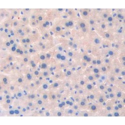 Testis Specific Kinase 1 (TESK1) Antibody