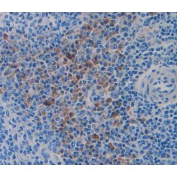 TNF Receptor Associated Factor 1 (TRAF1) Antibody