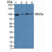 Western blot analysis of (1) Human HeLa cells, (2) Human Jurkat Cells, (3) Human HepG2 Cells and (4) Human Raji Cells.