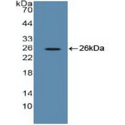 Eukaryotic Translation Elongation Factor 2 (EEF2) Antibody