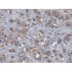 Eukaryotic Translation Elongation Factor 2 (EEF2) Antibody