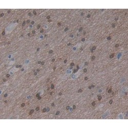 Eukaryotic Translation Elongation Factor 2 (EEF2) Antibody