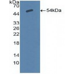Amiloride Sensitive Sodium Channel Subunit Alpha (SCNN1a) Antibody