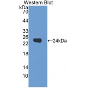 Western blot analysis of the recombinant protein.