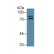 Western blot analysis of Rat Liver lysate, using Rat OS9 Antibody (1 µg/ml) and HRP-conjugated Goat Anti-Rabbit antibody (<a href="https://www.abbexa.com/index.php?route=product/search&amp;search=abx400043" target="_blank">abx400043</a>, 0.2 µg/ml).