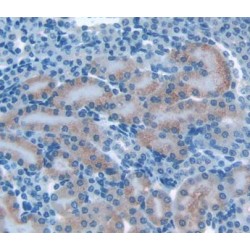 Osteosarcoma Amplified 9 (OS9) Antibody