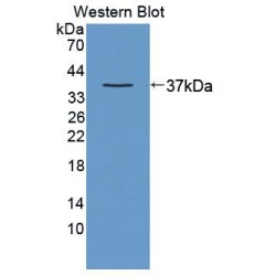 Endoplasmic Reticulum Lipid Raft Associated Protein 2 (ERLIN2) Antibody