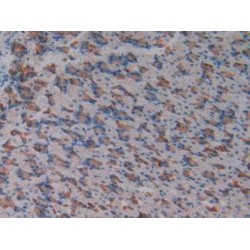 Activating Transcription Factor 1 (ATF1) Antibody